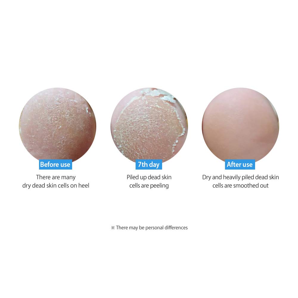 FRUDIA My Orchard Peach Foot Peeling Mask