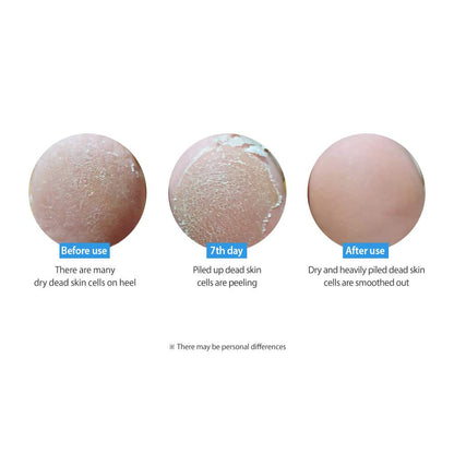 FRUDIA My Orchard Peach Foot Peeling Mask